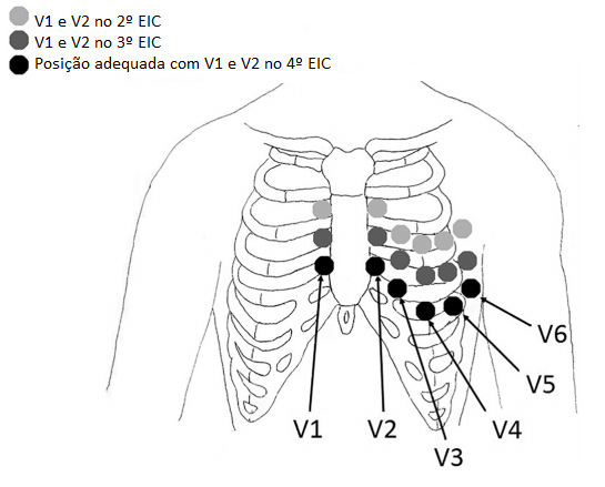 Ecgnow Telecardiologia 2164