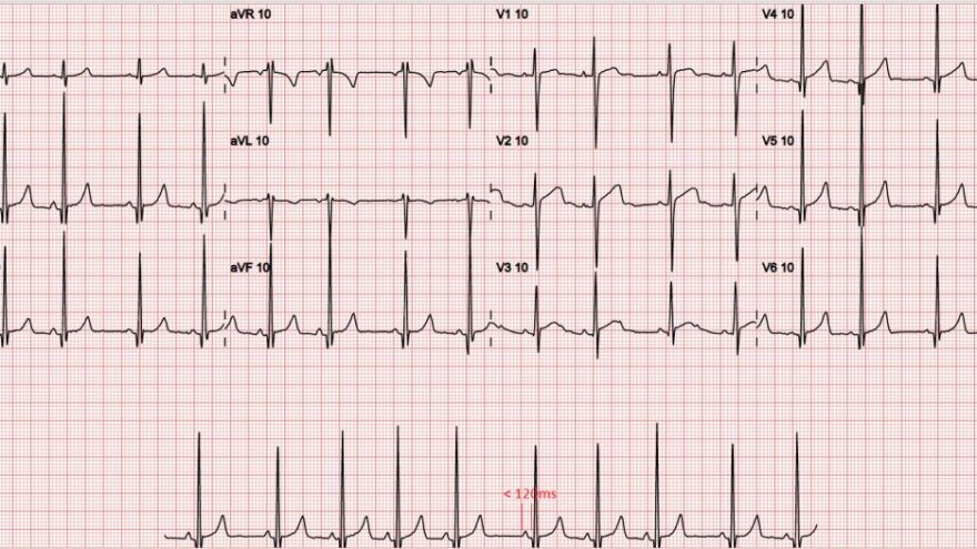 3-dicas-importantes-sobre-ECG-em-criancas