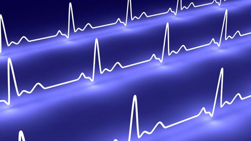 ECG-dentro-dos-limites-da-normalidade-sao-todos-iguais