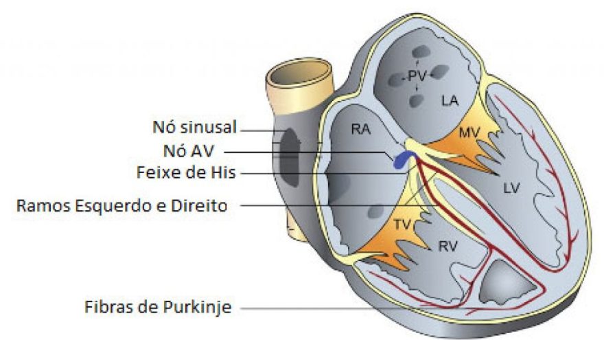 arritmia-supraventricular-ou-ventricular