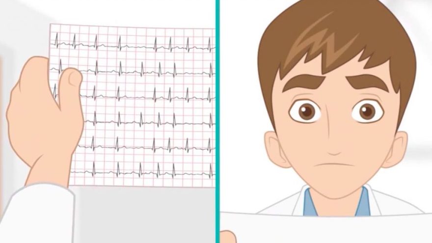 como-analisar-um-eletrocardiograma-parte-2