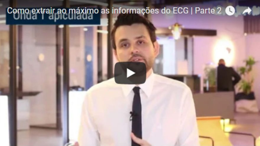 como-extrair-ao-maximo-as-informacoes-do-ECG-parte-2