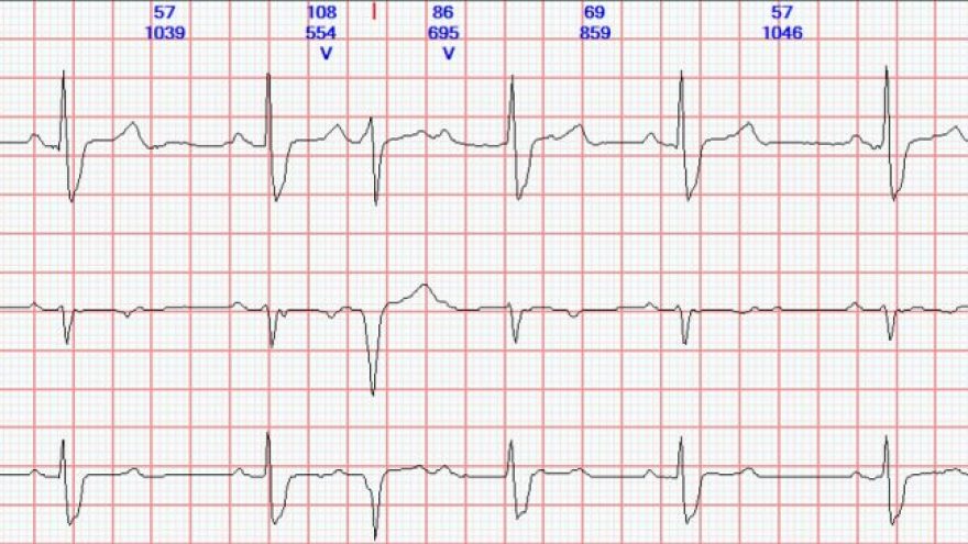 dicas-de-Holter-com-Dr-Acacio-F-Cardoso