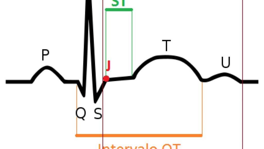 repolarizacao-ventricular